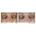 MULTI CORREXION&reg;&nbsp;Even Tone Occhi ROC 15ml