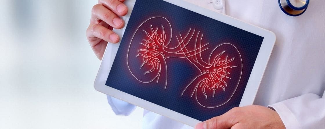 Come si formano i calcoli renali: cause e rimedi