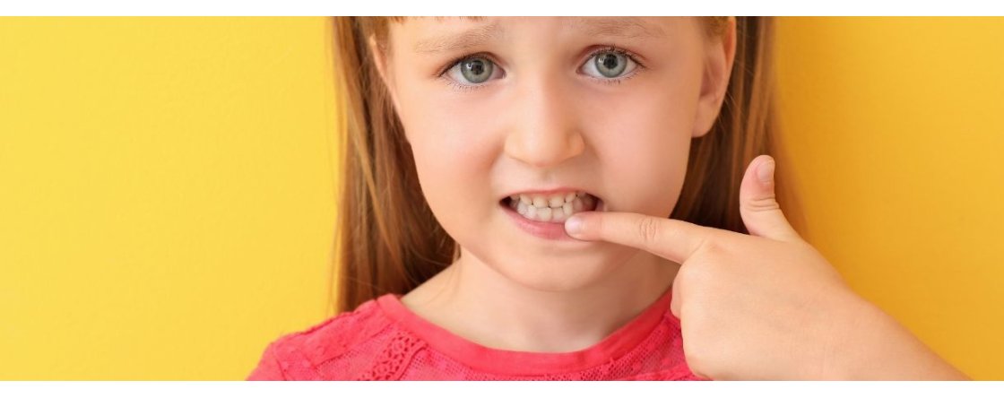 La stomatite nei bambini è contagiosa?