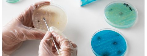 Come proteggersi dalla Candida auris? Come proteggersi dalla Candida auris?