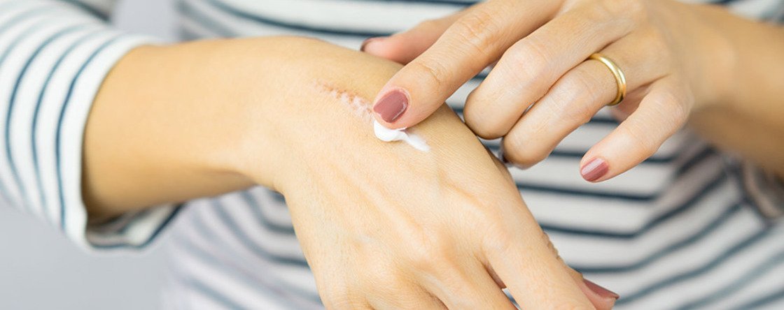 Che differenza c'è tra la Connettivina e la Connettivina Plus?