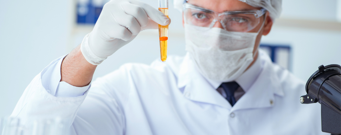 Glucosio nelle urine: quali sono i valori normali?