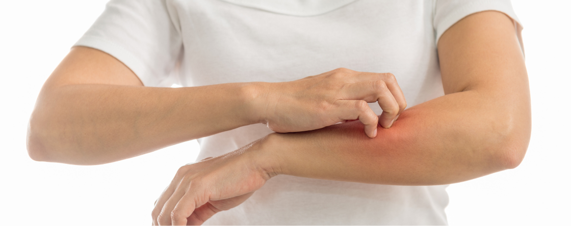 Quanto tempo ci vuole per guarire dall’herpes zoster