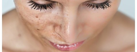 Quali sono i migliori sieri per eliminare le macchie dal viso? Quali sono i migliori sieri per eliminare le macchie dal viso?