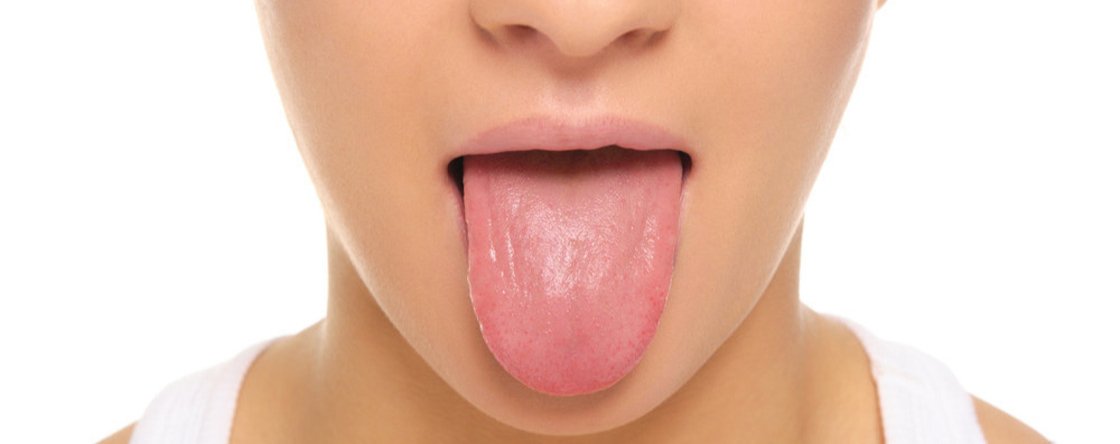 Come si cura il mughetto negli adulti?