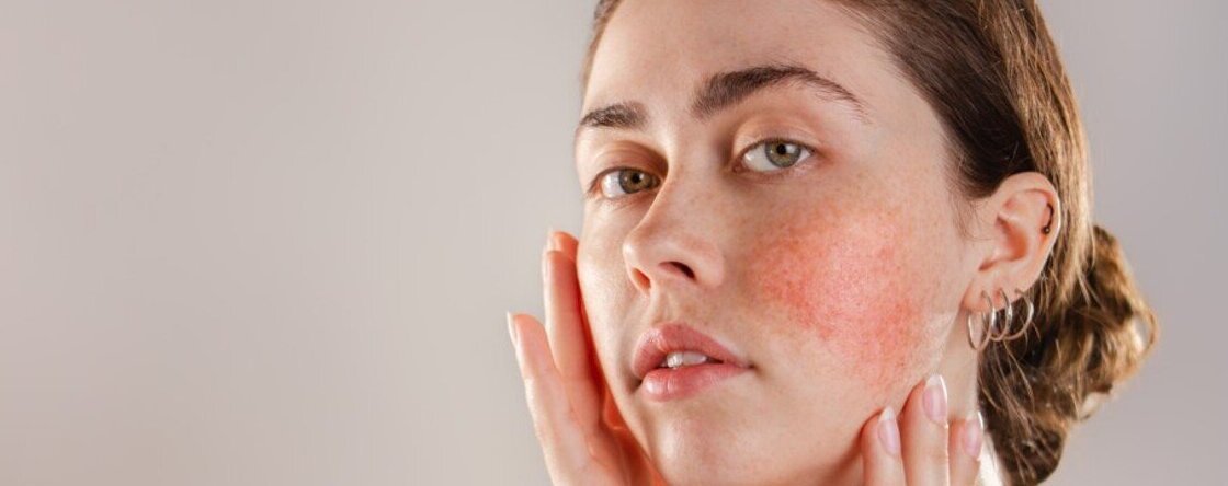 Che significa avere la pelle sensibile?