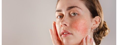 Che significa avere la pelle sensibile? Che significa avere la pelle sensibile?