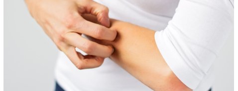Qual è il miglior antistaminico per il prurito?