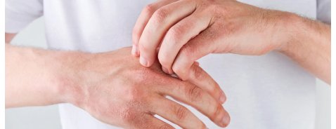 Quali sono le migliori creme per le ragadi alle mani?