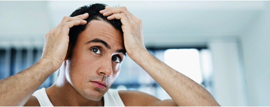 Come infoltire i capelli diradati e renderli più forti