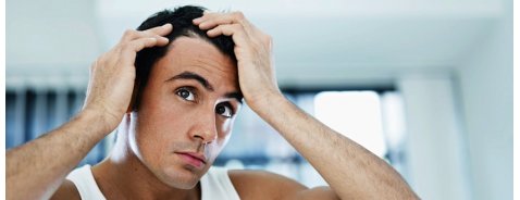 Come Prevenire la Caduta dei Capelli Come Prevenire la Caduta dei Capelli