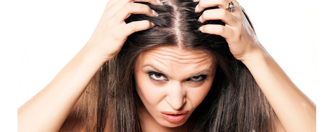 Dermatite seborroica e cuoio capelluto: cosa fare?