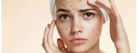 Routine di bellezza per pelli grasse Routine di bellezza per pelli grasse