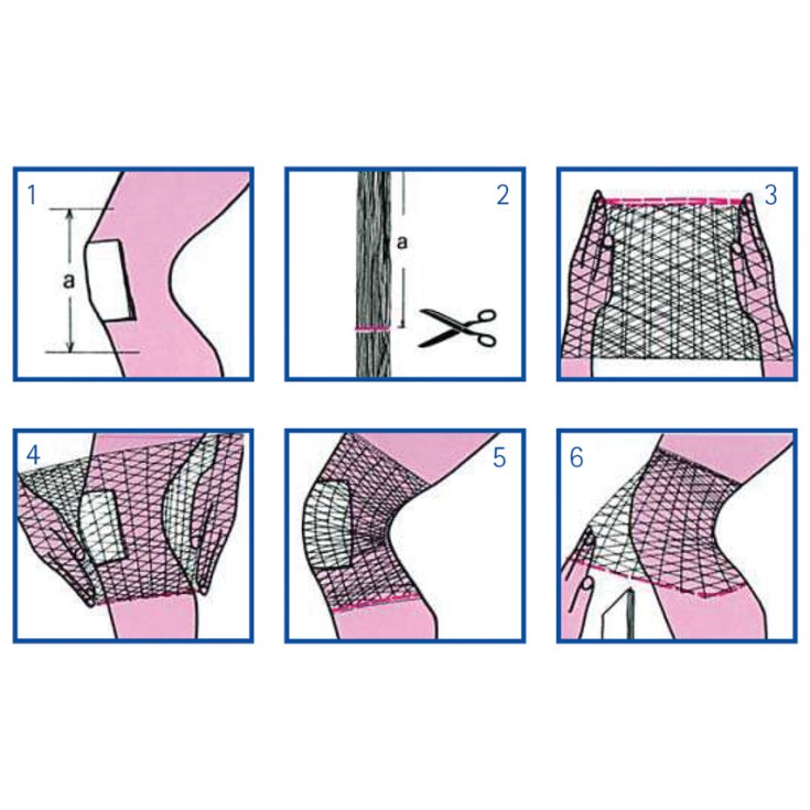 RETE TUBOLARE ELASTICA CALIB 5